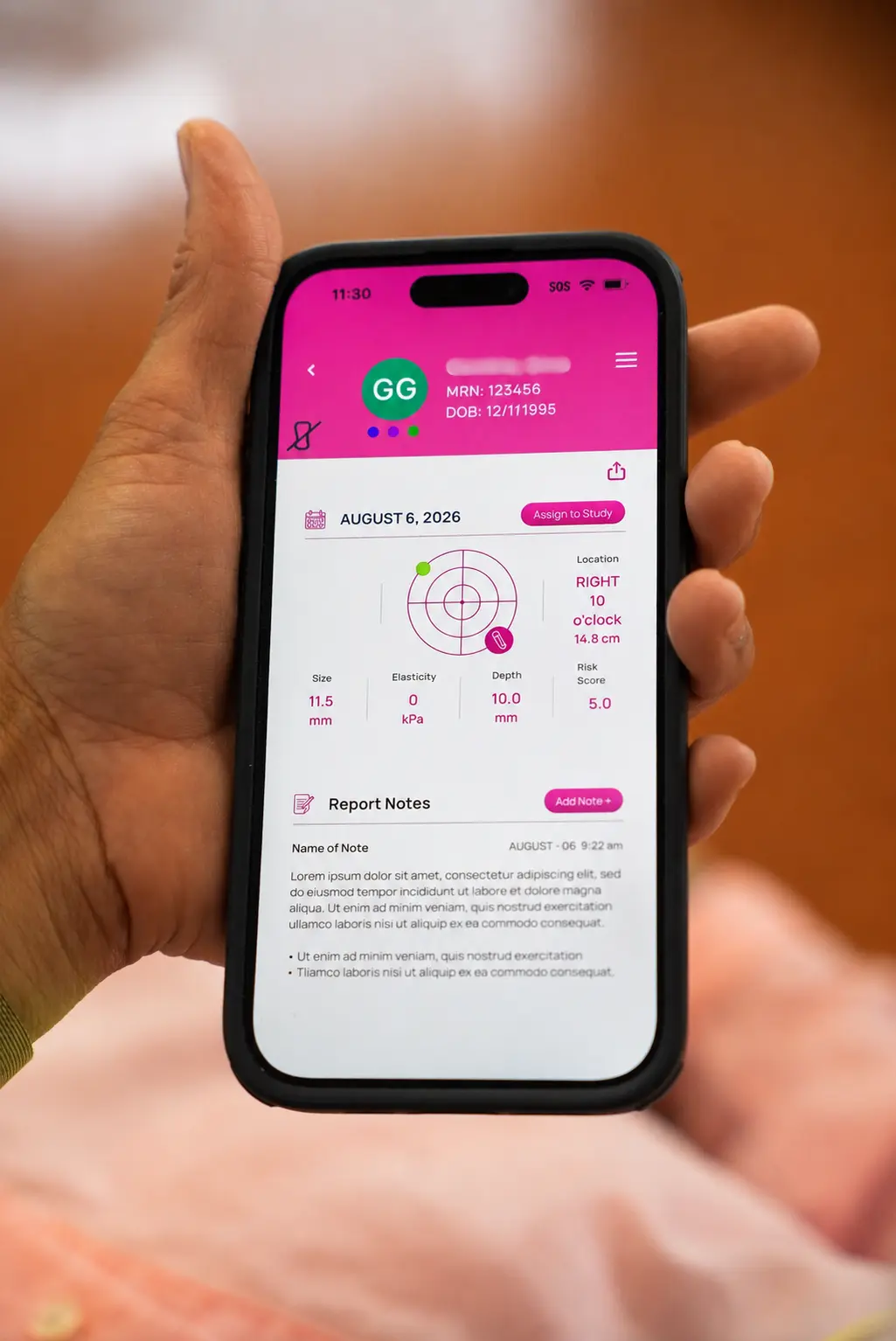 Catalina companion smartphone app showing real-time tumor characterization results